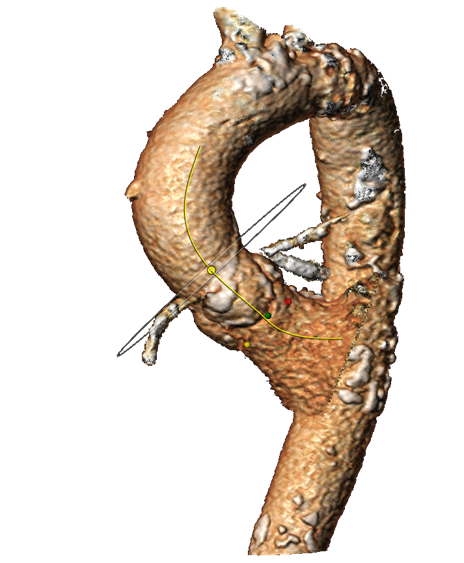 image-20250306154935-1.png
